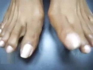 Huge Nailbeds Trinidad Feet