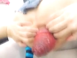 Sexy Prolapsed Asshole And Cervix