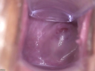 Charlie - Center Pocket