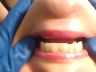 Gloved Mouth Exam