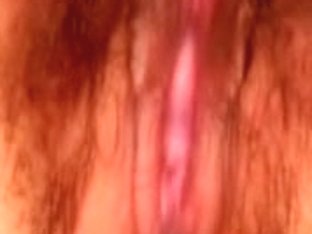 Spouse lying in expect.