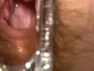 Showing The Inside Of My White Slender Wife With A Speculum