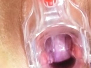 Large-breasted matured ob gyn exam