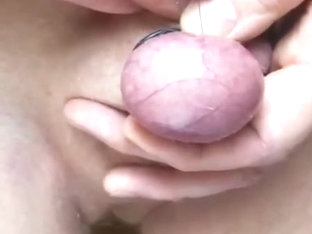 Akkupunkturnadel durch Hodensack