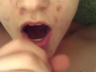 Spotty Adolescent Drops A Modest Load In His Own Mouth