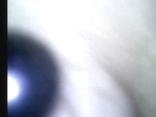 Endoscope details - hole balls cock foreskin belly nipples mouth sperm