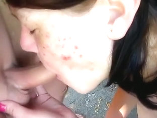 Girl With Tons Of Zits Sucks Off Her BF In Nature