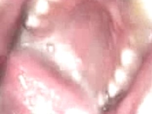 cum in eye,nose,ear