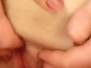 Greater Quantity clitoris head vs love button head close ups (Lesbo tribadism)