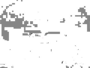 Stretched Cunt And Silicone Breasts In View