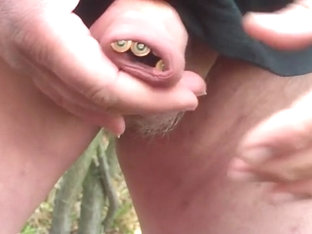 Outdoor foreskin, with 20 batteries