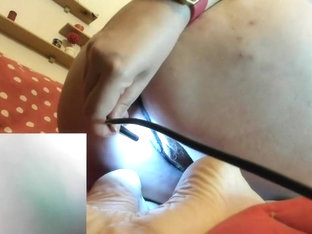 Farts Fetish And With A Medical Endoscope A Really Close View Of My Ass