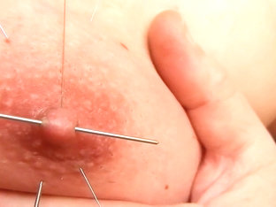 Long skewer and accupuncture needles