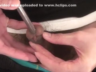 10 mm metallic ball sound inserting bladder and can't urinate